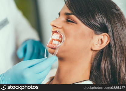 Teeth Whitening Procedure