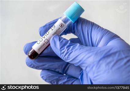 Test tube with blood sample for COVID-19 test. Negative test.