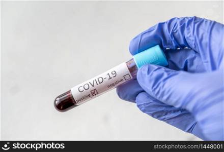 Test tube with blood sample for COVID-19 test. Positive test.