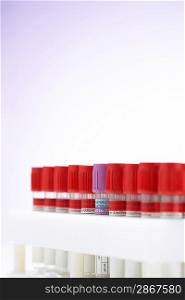Test tubes with red lids surrounding one with purple lid