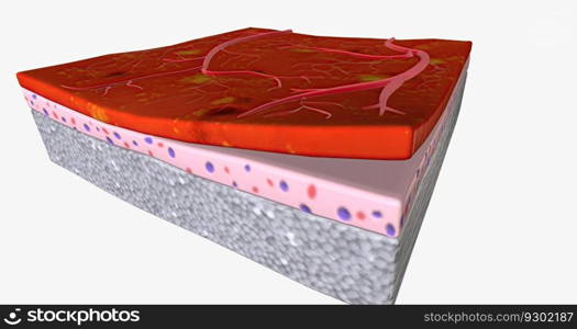 The abnormal blood vessels leak easily, causing the eye to fill with hemorrhages and exudates. 3D rendering. The abnormal blood vessels leak easily, causing the eye to fill with hemorrhages and exudates.