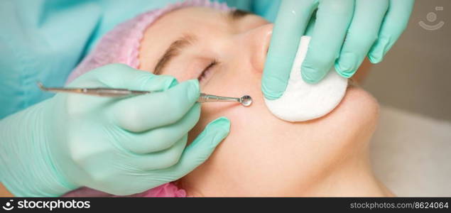 The beautician removes blackhead and acne on the female face in a beauty salon, blackhead removal tool. The beautician removes blackhead and acne on the female face in a beauty salon, blackhead removal tool.