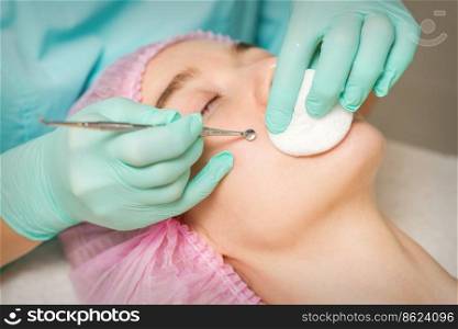 The beautician removes blackhead and acne on the female face in a beauty salon, blackhead removal tool. The beautician removes blackhead and acne on the female face in a beauty salon, blackhead removal tool.