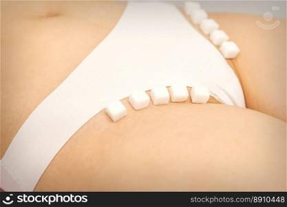 The concept of epilation, waxing, and intimate hygiene. Sugar cubes lying in a row on the bikini zone of a young white woman, close up. The concept of epilation, waxing, and intimate hygiene. Sugar cubes lying in a row on the bikini zone of a young white woman, close up.