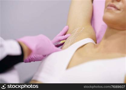 The doctor makes intramuscular injections of botulinum toxin in the underarm area against hyperhidrosis. Cosmetology skin care. Doctor makes intramuscular injections of botulinum toxin in the underarm area against hyperhidrosis.
