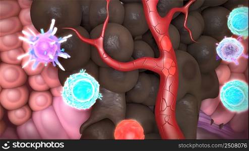 The immune system and cancer 3D illustration. The immune system and cancer