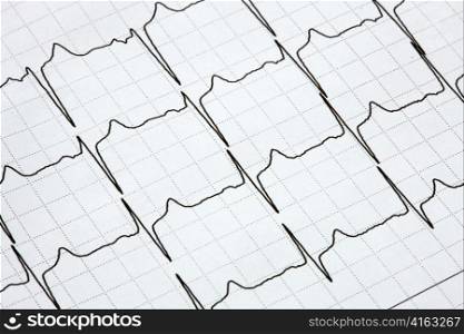 the lines of an ecg in a heart-study