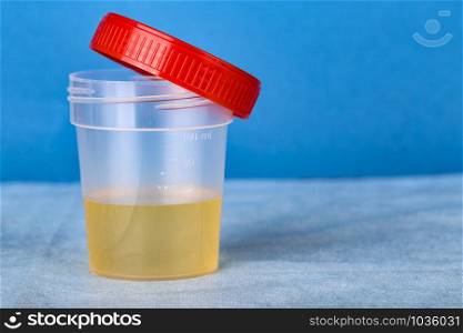 The Plastic container with urine analysis. New Plastic container with urine analysis