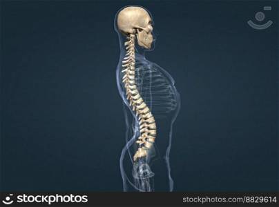 The swaying posture indicates an increase in posterior tilt of the pelvis and trunk and thoracic kyphosis 3d illustration. The swaying posture indicates an increase in posterior tilt of the pelvis and trunk and thoracic kyphosis.