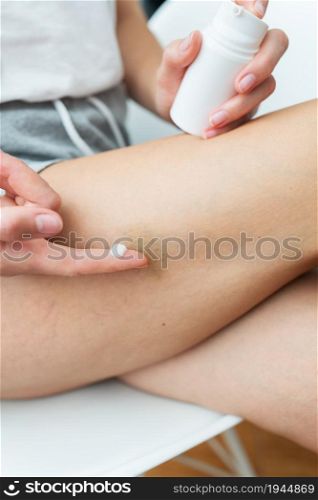 The woman has bruises on her legs, the girl spreads cream on the bruise. Domestic violence concept. Close-up. The woman has bruises on her legs, the girl spreads cream on the bruise. Domestic violence concept. Close-up.
