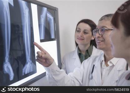 Three smiling doctors looking at x-rays of human bones, one doctor is pointing