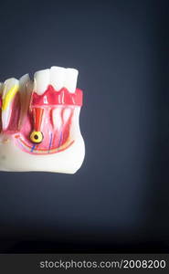 Tooth decay dentists dental model of teeth, gums and root canal