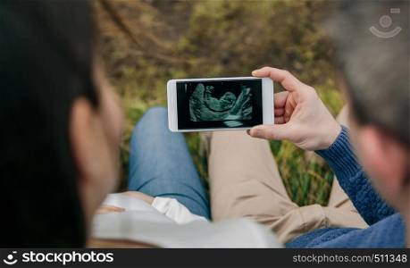 Top view of pregnant woman looking ultrasound of her baby on the mobile with her husband. Selective focus on mobile in background. Pregnant looking ultrasound on the mobile with her husband