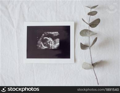 top view x ray photo fetus. Resolution and high quality beautiful photo. top view x ray photo fetus. High quality and resolution beautiful photo concept