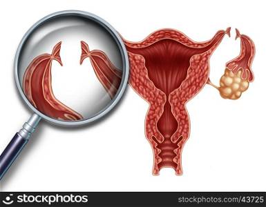 Tubal ligation reproduction medical procedure for female sterilization as a uterus with incisions on the fallopian tubes to block the egg from being fertilized as a fertility and gynecology medicine concept with 3D illustration elements.