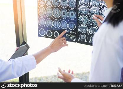 Two doctors analyzing a scan or x-ray film or explains a CT scan together with serious thoughtful expressions method with patient treatment results on brain to an anomaly on the film