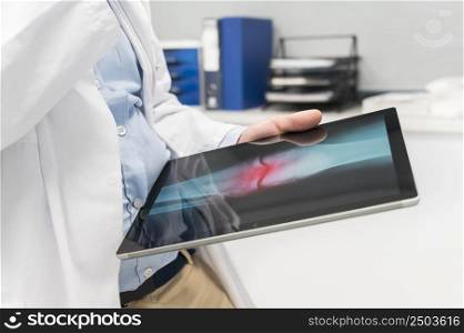 Unrecognizable Doctor is checking x-ray image at computer tablet, close up. Doctor at work in a hospital. Medicine and healthcare concept. High quality photography.. Unrecognizable Doctor is checking x-ray image at computer tablet, close up. Doctor at work in a hospital. Medicine and healthcare concept.
