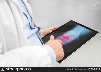 Unrecognizable Doctor is checking x-ray image at computer tablet, close up. Doctor at work in a hospital. Medicine and healthcare concept. High quality photography.. Unrecognizable Doctor is checking x-ray image at computer tablet, close up. Doctor at work in a hospital. Medicine and healthcare concept.