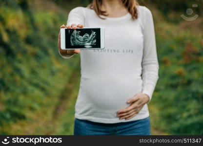 Unrecognizable pregnant woman showing ultrasound of her baby on the mobile. Selective focus on mobile in foreground. Pregnant showing ultrasound on the mobile