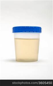 Urine sample in plastic pot