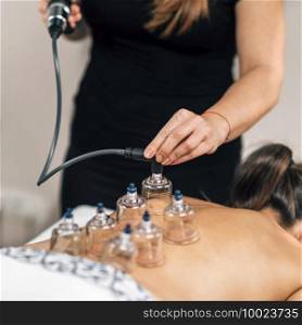 Vacuum Therapy. Therapist Placing Transparent Glass Cups on Woman’s Back