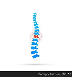 Vector human spine with pain isolated silhouette illustration. Spine pain medical center, clinic, rehabilitation. Vector stock illustration.