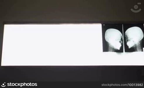 Male doctor at work in public medical clinic and examining x-ray plates of bones, skull, and lungs