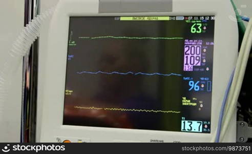 Screen of Russian multiparameter patient monitor in ambulance or hospital with female nurse doctor paramedic reflection