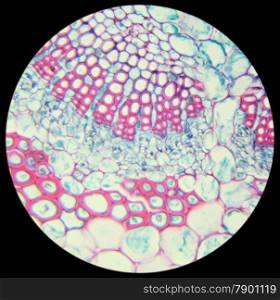 Winter Jasmine leaf under a microscope (Leaf of Winter Jasmine C.S.) (Jasminum nudiflorum), 400x