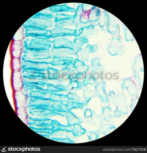 Winter Jasmine leaf under a microscope (Leaf of Winter Jasmine C.S.) (Jasminum nudiflorum), 400x