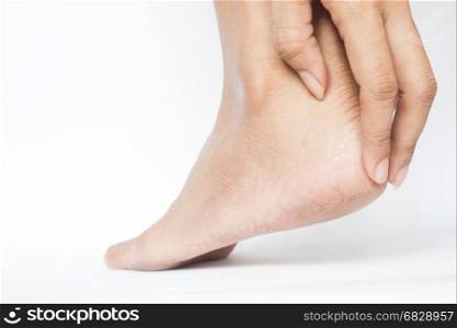 Woman cracked heels with white background, Foot healthy concept