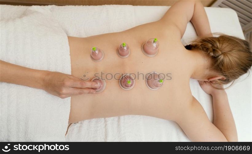 woman experiencing cupping therapy. High resolution photo. woman experiencing cupping therapy. High quality photo