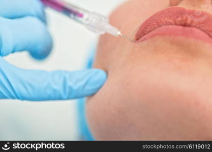 woman gets injection in her lips. Closeup of woman gets injection in her lips