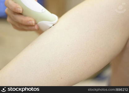 Woman make a legs depilation by using a hair removal device