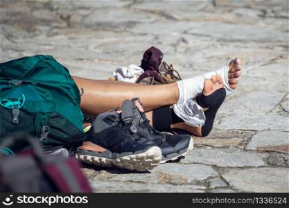Woman pilgrim legs with injured feet resting on Obradoiro square, Santiago de Compostela, Spain. Copy space