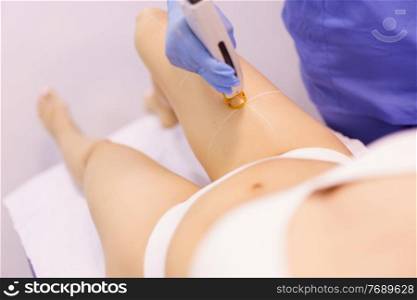 Woman receiving legs laser hair removal at a beauty center. Laser depilation treatment in an aesthetic clinic.. Woman receiving legs laser hair removal at a beauty center.