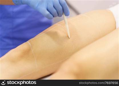 Woman receiving legs laser hair removal at a beauty center. Laser depilation treatment in an aesthetic clinic.. Woman receiving legs laser hair removal at a beauty center.