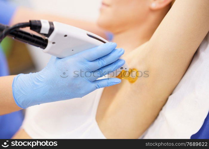 Woman receiving underarm laser hair removal at a beauty center. Laser depilation treatment in an aesthetic clinic.. Woman receiving underarm laser hair removal at a beauty center.