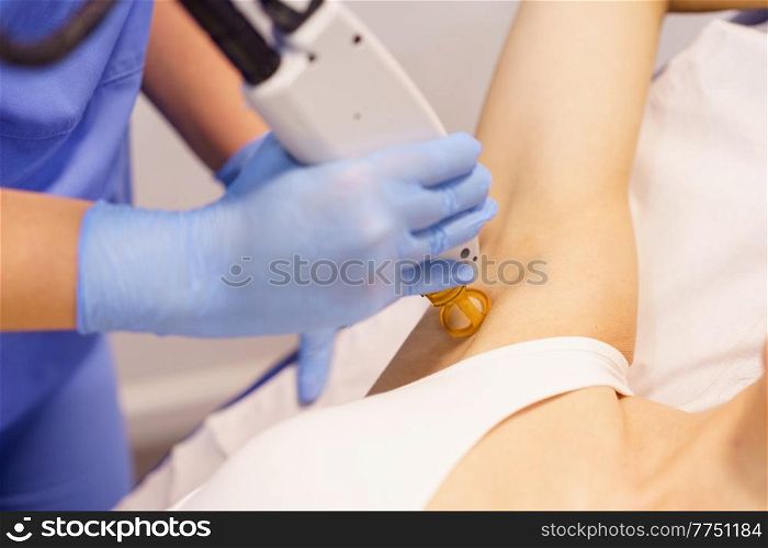 Woman receiving underarm laser hair removal at a beauty center. Laser depilation treatment in an aesthetic clinic.. Woman receiving underarm laser hair removal at a beauty center.