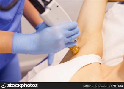 Woman receiving underarm laser hair removal at a beauty center. Laser depilation treatment in an aesthetic clinic.. Woman receiving underarm laser hair removal at a beauty center.