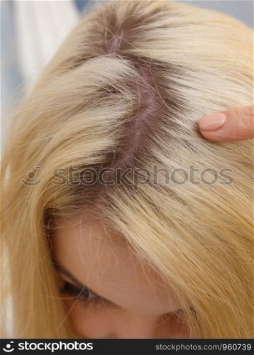Woman showing her hair regrowth roots after blonde dying. Close up of female head.. Woman showing blonde hair roots