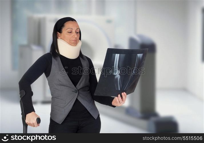 Woman with cervical collar and radiography in the hospital
