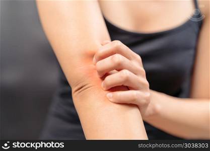 Women hand scratch the itch on arm, healthcare and medicine conc. Women hand scratch the itch on arm, healthcare and medicine concept.