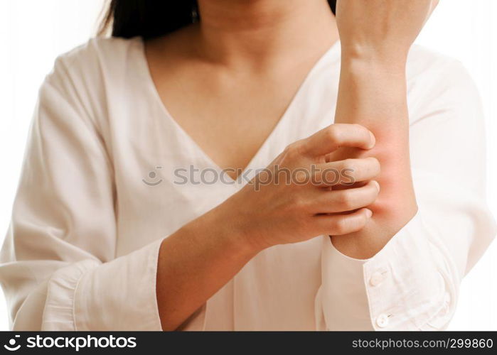 Women hand scratch the itch on arm, healthcare and medicine concept