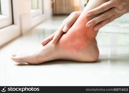 women leg ankle injury/painful, women touch the pain ankle leg