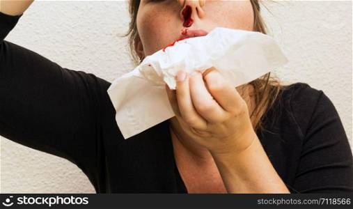 Wound nosebleed, woman bleeding from her nose, nose injury blood and tissue accident. Wound nosebleed, woman bleeding from her nose, nose injury blood and tissue
