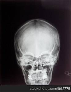 X ray film for human skull