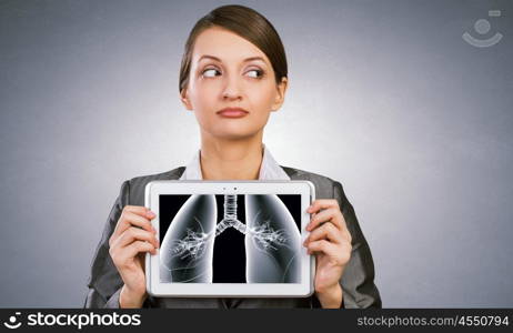 X-ray of lungs. Woman holding tablet pc with lungs xray concept