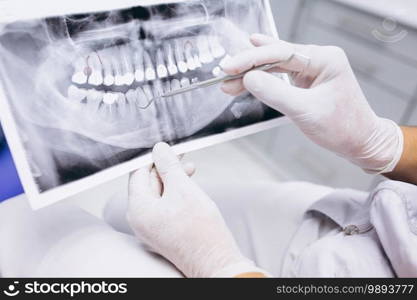 X-ray of teeth