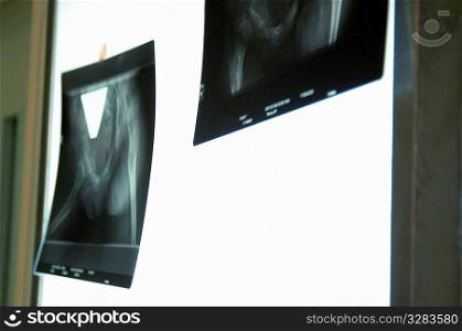 X-Rays on light board.